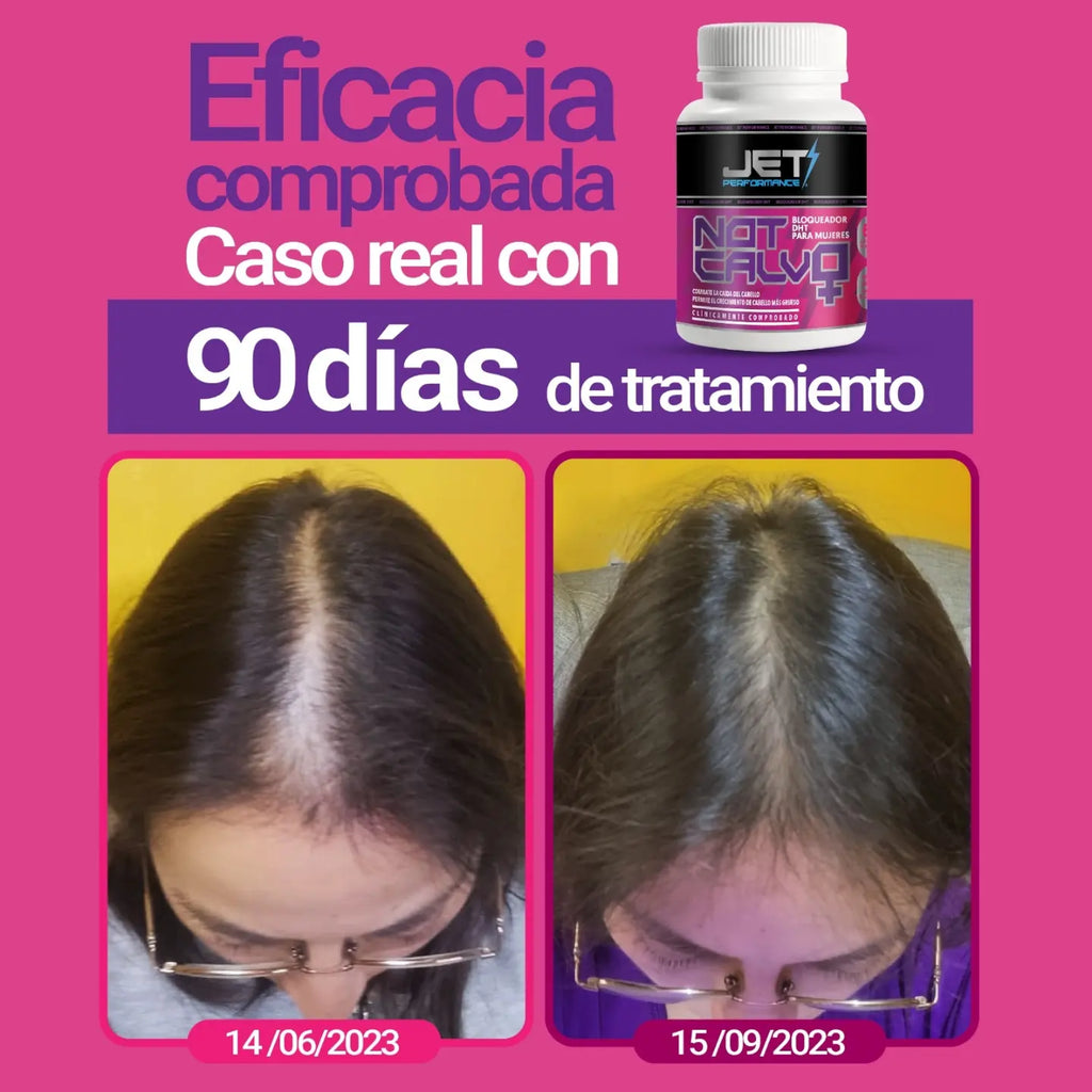 NOT CALVO FEMENINO 60 CAPS. (bloqueador de DHT)