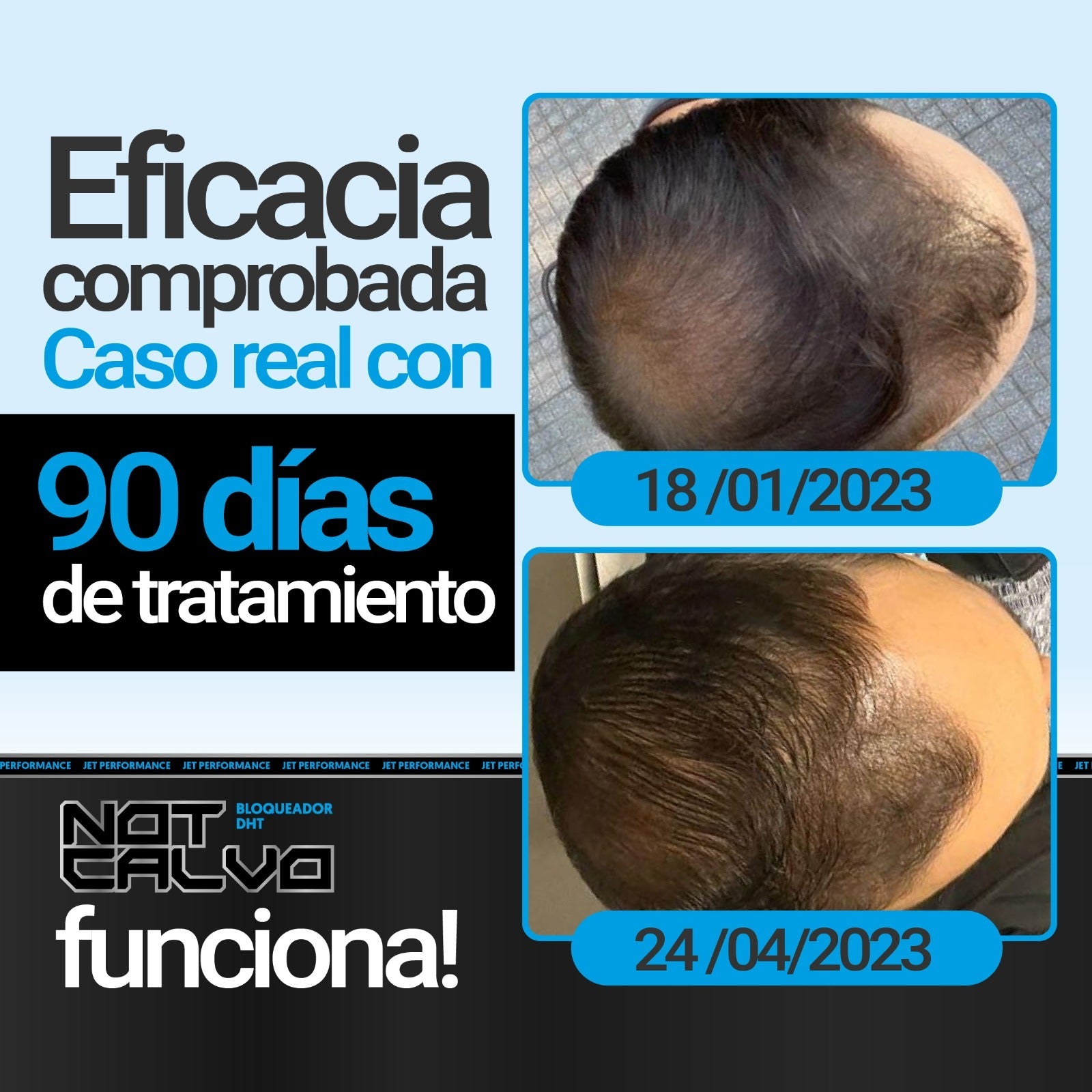 NOT CALVO 90 CAPS. (Bloqueador de DHT) - JET PERFORMANCE