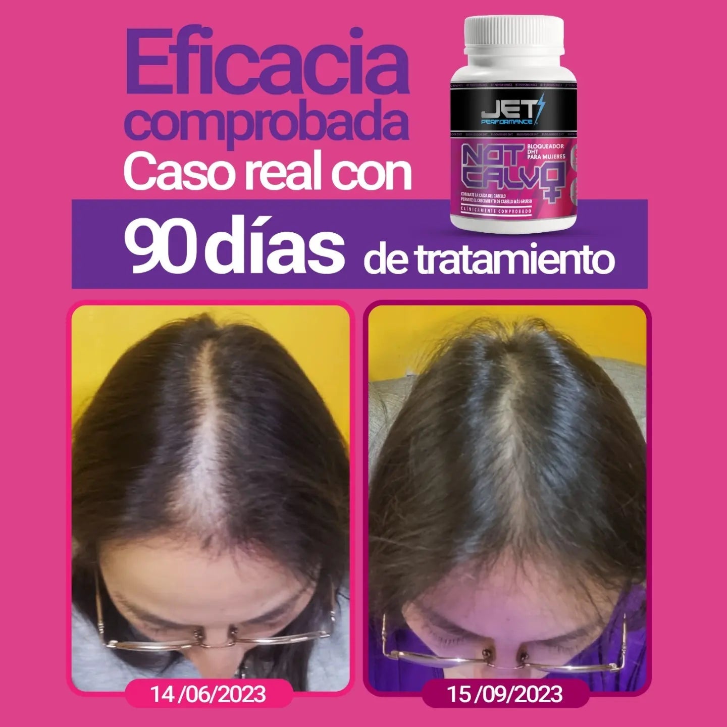NOT CALVO FEMENINO 60 CAPS. (bloqueador de DHT) - JET PERFORMANCE